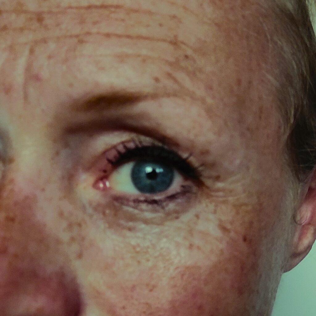 psychodermatologie